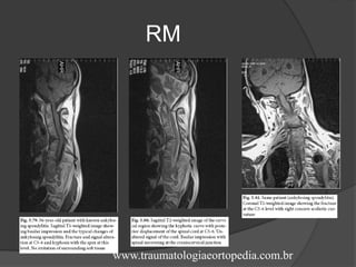 RM
www.traumatologiaeortopedia.com.br
 