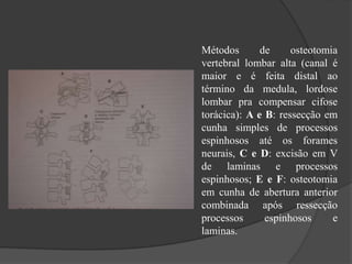 Métodos de osteotomia
vertebral lombar alta (canal é
maior e é feita distal ao
término da medula, lordose
lombar pra compensar cifose
torácica): A e B: ressecção em
cunha simples de processos
espinhosos até os forames
neurais, C e D: excisão em V
de laminas e processos
espinhosos; E e F: osteotomia
em cunha de abertura anterior
combinada após ressecção
processos espinhosos e
laminas.
 
