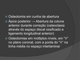  Osteotomia em cunha de abertura
 Ápice posterior → Abertura da coluna
anterior durante correção (osteoclasia
através do espaço discal ossificado e
ligamento longitudinal anterior)
 Osteotomias em múltiplos níveis, em “V”
no plano coronal, com a ponta do “V” na
linha média no espaço interlaminar
 