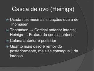 Casca de ovo (Heinigs)
 Usada nas mesmas situações que a de
Thomasen
 Thomasen → Cortical anterior intacta;
Heinigs → Fratura da cortical anterior
 Coluna anterior e posterior
 Quanto mais osso é removido
posteriormente, mais se consegue ↑ da
lordose
 