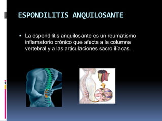 ESPONDILITIS ANQUILOSANTE

 La espondilitis anquilosante es un reumatismo
  inflamatorio crónico que afecta a la columna
  vertebral y a las articulaciones sacro ilíacas.
 