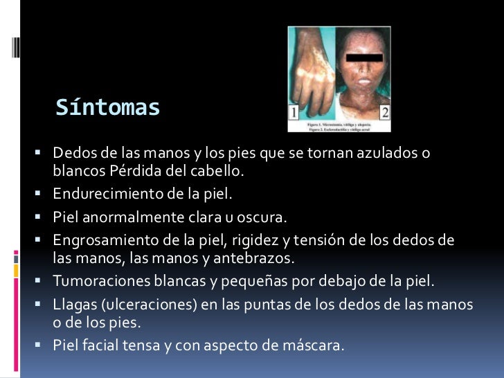 Las vitaminas para los cabellos medobiotin las revocaciones