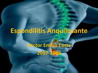 Espondilitis Anquilosante
     Héctor Emilio Coste
         2007-1009
 