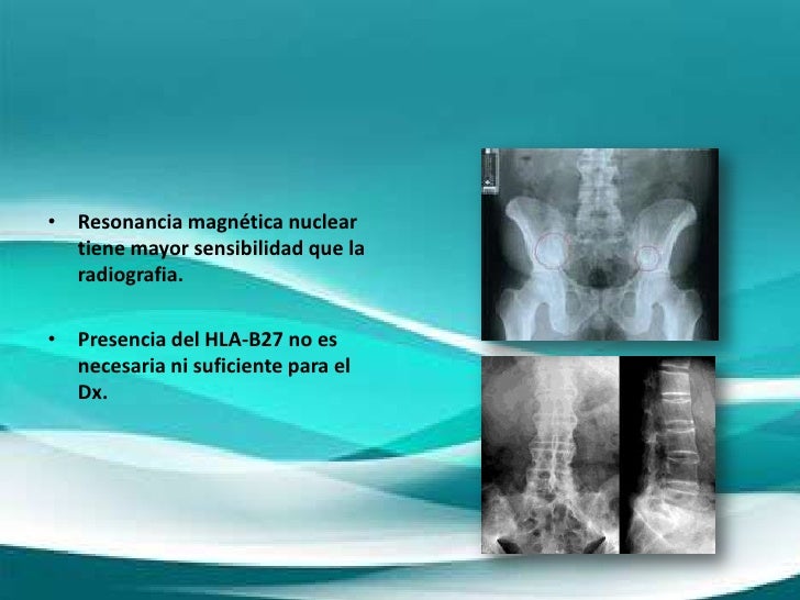 Una alimentación por el arroz a la osteocondrosis
