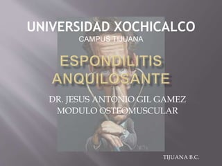 DR. JESUS ANTONIO GIL GAMEZ
MODULO OSTEOMUSCULAR
TIJUANA B.C.
UNIVERSIDAD XOCHICALCO
CAMPUS TIJUANA
 