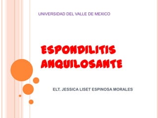 ESPONDILITIS
ANQUILOSANTE
ELT. JESSICA LISET ESPINOSA MORALES
UNIVERSIDAD DEL VALLE DE MEXICO
 