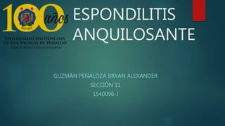 ESPONDILITIS
ANQUILOSANTE
GUZMÁN PEÑALOZA BRYAN ALEXANDER
SECCIÓN 11
1540096-J
 
