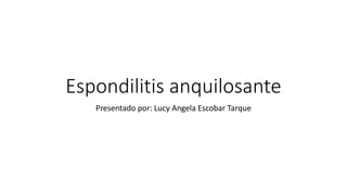 Espondilitis anquilosante
Presentado por: Lucy Angela Escobar Tarque
 