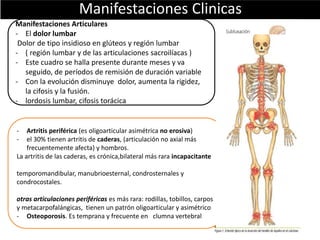 Manifestaciones Clinicas
Manifestaciones Articulares
- El dolor lumbar
Dolor de tipo insidioso en glúteos y región lumbar
- ( región lumbar y de las articulaciones sacroilíacas )
- Este cuadro se halla presente durante meses y va
seguido, de períodos de remisión de duración variable
- Con la evolución disminuye dolor, aumenta la rigidez,
la cifosis y la fusión.
- lordosis lumbar, cifosis torácica
- Artritis periférica (es oligoarticular asimétrica no erosiva)
- el 30% tienen artritis de caderas, (articulación no axial más
frecuentemente afecta) y hombros.
La artritis de las caderas, es crónica,bilateral más rara incapacitante
temporomandibular, manubrioesternal, condrosternales y
condrocostales.
otras articulaciones periféricas es más rara: rodillas, tobillos, carpos
y metacarpofalángicas, tienen un patrón oligoarticular y asimétrico
- Osteoporosis. Es temprana y frecuente en clumna vertebral
 