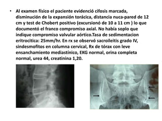 • Al examen físico el paciente evidenció cifosis marcada,
disminución de la expansión torácica, distancia nuca-pared de 12
cm y test de Chobert positivo (excursionó de 10 a 11 cm ) lo que
documentó el franco compromiso axial. No había soplo que
indique compromiso valvular aórtico.Tasa de sedimentacion
eritrocitica: 25mm/hr. En rx se observó sacroileitis grado IV,
sindesmofitos en columna cervical, Rx de tórax con leve
ensanchamiento mediastínico, EKG normal, orina completa
normal, urea 44, creatinina 1,20.
 
