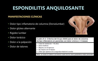 MANIFESTACIONES CLÍNICAS
• Dolor tipo inflamatorio de columna (Dorsolumbar)
• Dolor glúteo alternante
• Rigidez lumbar
• Dolor torácico
• Dolor a la palpación
• Dolor de talones
ESPONDILITIS ANQUILOSANTE
 