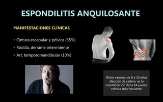 MANIFESTACIONES CLÍNICAS
• Cintura escapular y pélvica (35%)
• Rodilla, derrame intermitente
• Art. temporomandibular (10%)
ESPONDILITIS ANQUILOSANTE
Niños varones de 8 a 10 años
afección de cadera es la
manifestación de la EA juvenil
crónica más frecuente
 