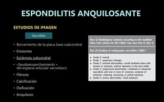 ESTUDIOS DE IMAGEN
• Borramiento de la placa ósea subcondral
• Erosiones
• Esclerosis subcondral
• «Seudoensanchamiento »
del espacio articular sacroilíaco
• Fibrosis
• Calcificación
• Osificación
• Anquilosis
ESPONDILITIS ANQUILOSANTE
Sacroilitis
 