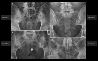 GRADO 2GRADO 1
GRADO 3 GRADO 4
 