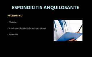 PRONÓSTICO
• Variable
• Remisiones/Exacerbaciones espontáneas
• Favorable
ESPONDILITIS ANQUILOSANTE
 
