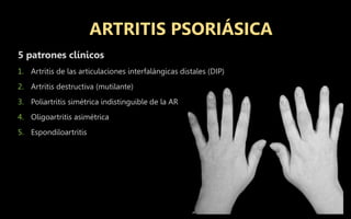 5 patrones clínicos
1. Artritis de las articulaciones interfalángicas distales (DIP)
2. Artritis destructiva (mutilante)
3. Poliartritis simétrica indistinguible de la AR
4. Oligoartritis asimétrica
5. Espondiloartritis
ARTRITIS PSORIÁSICA
 