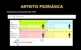ARTRITIS PSORIÁSICA
Psoriasis Area and Severity Index (PASI)
 
