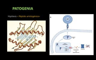 PATOGENIA
Hipótesis « Péptido artritogénico»
 