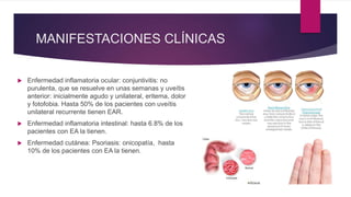 MANIFESTACIONES CLÍNICAS
 Enfermedad inflamatoria ocular: conjuntivitis: no
purulenta, que se resuelve en unas semanas y uveítis
anterior: inicialmente agudo y unilateral, eritema, dolor
y fotofobia. Hasta 50% de los pacientes con uveítis
unilateral recurrente tienen EAR.
 Enfermedad inflamatoria intestinal: hasta 6.8% de los
pacientes con EA la tienen.
 Enfermedad cutánea: Psoriasis: onicopatía, hasta
10% de los pacientes con EA la tienen.
 