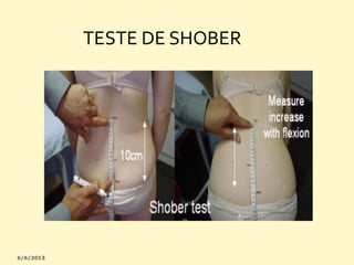 TESTE DE SHOBER

 
