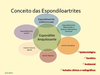 Conceito das Espondiloartrites
Espondiloartrite
Indiferenciada

Epidemiológico
Genético
Ambiental
Achados clínicos e radiográficos

 
