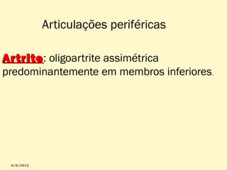 Articulações periféricas
Ar trite: oligoartrite assimétrica
trite
predominantemente em membros inferiores.

 