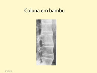 Coluna em bambu

 