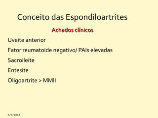 Conceito das Espondiloartrites
Achados clínicos
Uveite anterior
Fator reumatoide negativo/ PAIs elevadas
Sacroileíte
Entesite
Oligoartrite > MMII

 