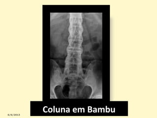 Coluna em Bambu

 