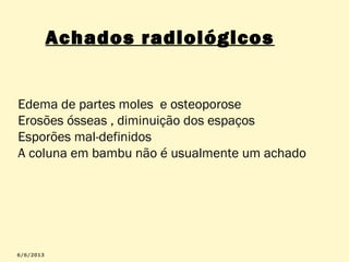 Achados radiológicos
Edema de partes moles e osteoporose
Erosões ósseas , diminuição dos espaços
Esporões mal-definidos
A coluna em bambu não é usualmente um achado

 