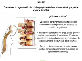 Espondiloartrosis Cervical Y Lumbo Sacra PPT espondiloartrosis-cervical-y-lumbo-sacra-ppt