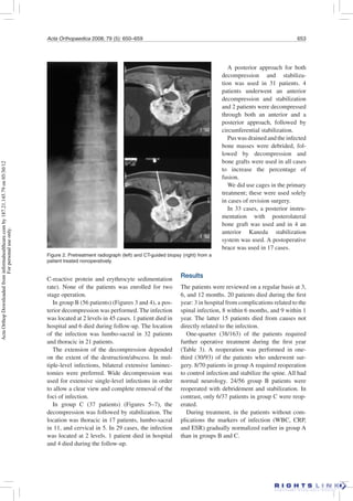 Acta Orthopaedica 2008; 79 (5): 650–659 653
C-reactive protein and erythrocyte sedimentation
rate). None of the patients was enrolled for two
stage operation.
In group B (56 patients) (Figures 3 and 4), a pos-
terior decompression was performed. The infection
was located at 2 levels in 45 cases. 1 patient died in
hospital and 6 died during follow-up. The location
of the infection was lumbo-sacral in 32 patients
and thoracic in 21 patients.
The extension of the decompression depended
on the extent of the destruction/abscess. In mul-
tiple-level infections, bilateral extensive laminec-
tomies were preferred. Wide decompression was
used for extensive single-level infections in order
to allow a clear view and complete removal of the
foci of infection.
In group C (37 patients) (Figures 5–7), the
decompression was followed by stabilization. The
location was thoracic in 17 patients, lumbo-sacral
in 11, and cervical in 5. In 29 cases, the infection
was located at 2 levels. 1 patient died in hospital
and 4 died during the follow-up.
Results
The patients were reviewed on a regular basis at 3,
6, and 12 months. 20 patients died during the ﬁrst
year: 3 in hospital from complications related to the
spinal infection, 8 within 6 months, and 9 within 1
year. The latter 15 patients died from causes not
directly related to the infection.
One-quarter (38/163) of the patients required
further operative treatment during the ﬁrst year
(Table 3). A reoperation was performed in one-
third (30/93) of the patients who underwent sur-
gery. 8/70 patients in group A required reoperation
to control infection and stabilize the spine. All had
normal neurology. 24/56 group B patients were
reoperated with debridement and stabilization. In
contrast, only 6/37 patients in group C were reop-
erated.
During treatment, in the patients without com-
plications the markers of infection (WBC, CRP,
and ESR) gradually normalized earlier in group A
than in groups B and C.
Figure 2. Pretreatment radiograph (left) and CT-guided biopsy (right) from a
patient treated nonoperatively.
A posterior approach for both
decompression and stabiliza-
tion was used in 31 patients. 4
patients underwent an anterior
decompression and stabilization
and 2 patients were decompressed
through both an anterior and a
posterior approach, followed by
circumferential stabilization.
Pus was drained and the infected
bone masses were debrided, fol-
lowed by decompression and
bone grafts were used in all cases
to increase the percentage of
fusion.
We did use cages in the primary
treatment; these were used solely
in cases of revision surgery.
In 33 cases, a posterior instru-
mentation with posterolateral
bone graft was used and in 4 an
anterior Kaneda stabilization
system was used. A postoperative
brace was used in 17 cases.
ActaOrthopDownloadedfrominformahealthcare.comby187.21.145.79on05/30/12
Forpersonaluseonly.
 