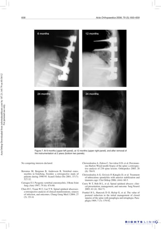 658 Acta Orthopaedica 2008; 79 (5): 650–659
Christodoulou A, Zidrou C, Savvidou O D, et al. Percutane-
ous Harlow Wood needle biopsy of the spine: a retrospec-
tive analysis of 238 spine lesions. Orthopedics 2005; 28
(8): 784-9.
Christodoulou A G, Givissis P, Kataglis D, et al. Treatment
of tuberculous spondylitis with anterior stabilization and
titanium cage. Clin Orthop 2006; (444): 60-5.
Curry W T, Hoh B L, et al. Spinal epidural abscess: clini-
cal presentation, management, and outcome. Surg Neurol
2005; 63 (4): 364-71.
Frankel H L, Hancock D O, Hylop G, et al. The value of
postural reduction in the initial management of closed
injuries of the spine with paraplegia and tetraplegia. Para-
plegia 1969; 7 (3): 179-92.
Figure 7. At 6 months (upper left panel), at 12 months (upper right panel), and after removal of
the instrumentation at 2 years (bottom two panels).
6 months 12 months
24 months 24 months
No competing interests declared.
Beronius M, Bergman B, Andersson R. Vertebral osteo-
myelitis in Goteborg, Sweden: a retrospective study of
patients during 1990-95. Scand J Infect Dis 2001; 33 (7):
527-32.
Carragee E J. Pyogenic vertebral osteomyelitis. J Bone Joint
Surg (Am) 1997; 79 (6): 874-80.
Chen H C, Tzaan W C, Lui T N. Spinal epidural abscesses:
a retrospective analysis of clinical manifestations, sources
of infection, and outcomes. Chang Gung Med J 2004; 27
(5): 351-8.
ActaOrthopDownloadedfrominformahealthcare.comby187.21.145.79on05/30/12
Forpersonaluseonly.
 