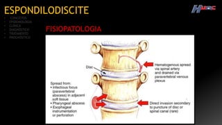 ESPONDILODISCITE
• CONCEITOS
• EPIDEMIOLOGIA
• CLÍNICA
• DIAGNÓSTICO
• TRATAMENTO
• PROGNÓSTICO
FISIOPATOLOGIA
 