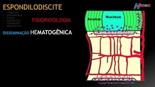 ESPONDILODISCITE
• CONCEITOS
• EPIDEMIOLOGIA
• CLÍNICA
• DIAGNÓSTICO
• TRATAMENTO
• PROGNÓSTICO
FISIOPATOLOGIA
DISSEMINAÇÃO HEMATOGÊ̂NICA
 