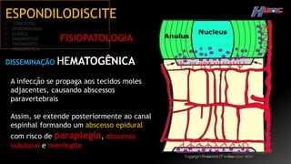 ESPONDILODISCITE
• CONCEITOS
• EPIDEMIOLOGIA
• CLÍNICA
• DIAGNÓSTICO
• TRATAMENTO
• PROGNÓSTICO
FISIOPATOLOGIA
DISSEMINAÇÃO HEMATOGÊ̂NICA
A infecção se propaga aos tecidos moles
adjacentes, causando abscessos
paravertebrais
Assim, se extende posteriormente ao canal
espinhal formando um abscesso epidural
com risco de paraplegia, abscesso
subdural e meningite
 