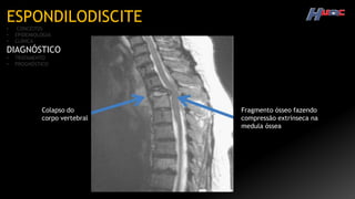 ESPONDILODISCITE
• CONCEITOS
• EPIDEMIOLOGIA
• CLÍNICA
DIAGNÓSTICO
• TRATAMENTO
• PROGNÓSTICO
Colapso do
corpo vertebral
Fragmento ósseo fazendo
compressão extrínseca na
medula óssea
 