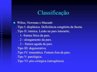 Classificação
 Wiltse, Newman e Macnab:
. Tipo I: displásica. Deficiência congênita da faceta.
. Tipo II: ístmica. Lesão na pars interartic.
. 1- fratura lítica da pars.
. 2 - alongamento da pars.
. 3 – fratura aguda da pars.
. Tipo III: degenerativa.
. Tipo IV: traumática. Fratura fora da pars.
. Tipo V: patológica.
. Tipo VI: pós-cirúrgica (iatrogênica).
 