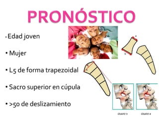 • Edad joven
• Mujer
• L5 de forma trapezoidal
• Sacro superior en cúpula
• >50 de deslizamiento
 