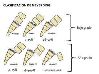 CLASIFICACIÓN DE MEYERDING
Bajo grado
Alto grado
0-25% 26-50%
51-75% 76-100% Espondiloptosis
 