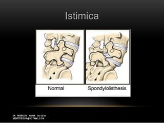 IstimicaIstimica
 