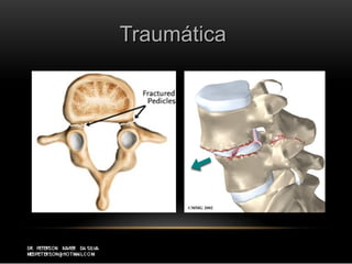 TraumáticaTraumática
 