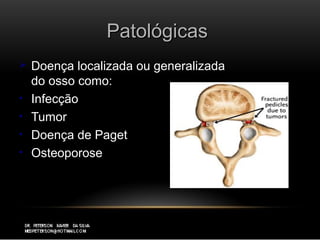 PatológicasPatológicas
 Doença localizada ou generalizadaDoença localizada ou generalizada
do osso como:do osso como:
• InfecçãoInfecção
• TumorTumor
• Doença de PagetDoença de Paget
• OsteoporoseOsteoporose
 