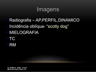 ImagensImagens
 Radiografia – AP,PERFIL,DINAMICORadiografia – AP,PERFIL,DINAMICO
 Incidência oblíqua-Incidência oblíqua- “scotty dog”“scotty dog”
 MIELOGRAFIAMIELOGRAFIA
 TCTC
 RMRM
 