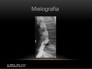 MielografiaMielografia
 