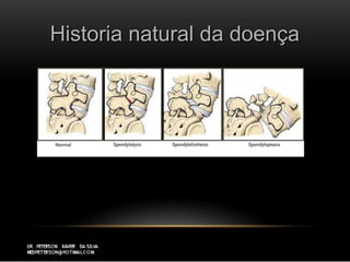 Historia natural da doençaHistoria natural da doença
 