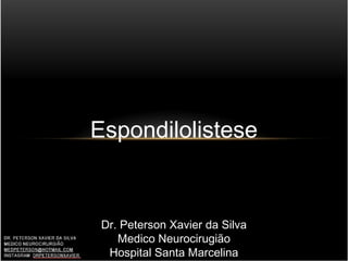 Espondilolistese
Dr. Peterson Xavier da Silva
Medico Neurocirugião
Hospital Santa Marcelina
 