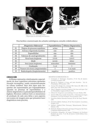 0Revista Científica do HCE
Figura 15a e 15b. Sinal do pão-duro
- degeneração da articulação interfacetária.
Figura 16. Sinal da chave inglesa
- degeneração da articulação
interfacetária.
CONCLUSÃO
A Olistese representa o deslizamento, especial-
mente de duas superfícies articulares oponentes
(luxação incompleta), usado caracteristicamente
na coluna vertebral. Seus dois tipos mais fre-
qüentes são representados por Espondilolistese
(quando na presença de espondilólise) e a
olistese degenerativa ou pseudoespondilolistese de
Jughans. Devemos conhecer bem os mecanismos
de produção de cada uma delas e seus aspectos
nos exames de imagem para que possamos fazer
diagnósticos mais precisos.
REFERÊNCIAS BIBLIOGRÁFICAS
1. Greenspan A. Radiologia ortopédica. 2ª Ed. Rio de Janeiro:
Guanabara Koogan, 996.
2. Resnick D. Diagnosis of bone and joint disorders. 3rd ed.
Philadelphia: WB Saunders, 1995.
3. Amour TES, Hodges SC, Laakman RW, Tamas DE. MRI of the
spine. New York: Raven Press, 1994.
4. Atlas S. Magnetic resonance imaging of the brain and spine. 2nd
ed. Philadelphia: Lippincott-Raven, 1996.
5. Osborn AG. Diagnostic neuroradiology. St. Louis: Mosby, 1994.
6. Ferreira ABH. Novo Aurélio Século XXI – o Dicionário da Língua
Portuguesa. 3ª ed. Rio de Janeiro: Nova Fronteira, 1999.
7. Dicionário Médico Ilustrado Dorland. 28ª ed. São Paulo: Manole,
999.
8. Dicionário Médico Stedman. 23ª ed. Rio de Janeiro: Guanabara
Koogan, 979.
9. Webster’s Medical Desk Dictionary. Massachussetts: Merrian-
Webster, 986.
10. Michaelis: Moderno Dicionário da Língua Portuguesa. São Paulo:
Companhia Melhoramentos, 998.
11. Vocabulário Ortográfico da Língua Portuguesa da Academia
Brasileira de Letras. 3ª ed. Rio de Janeiro: Corbã Editora Artes
Gráficas, 1999.
Para facilitar a memorização dos achados radiológicos, consulte a tabela abaixo:
Diagnóstico Diferencial Espondilolistese olistese Degenerativa
0 Degrau do processo espinhoso acima abaixo
02 Artrose e hipertrofia facetária não sim
03 Espondilólise sim não
04 Estenose de canal (geralmente) não sim
05 Nível mais freqüente L5-S1 L4-L5
06 Idade jovem idoso
07 Sexo (mais freqüente) masculino feminino
08 Graduação  a 4 
09 Número de níveis comprometidos   ou mais
0 Radiculopatia (freqüentemente) negativo positivo
 