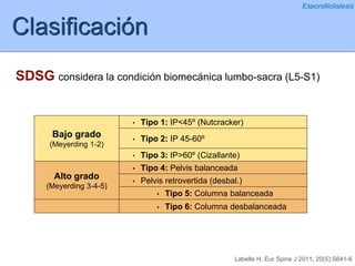 Clasificación
Espondilolistesis
SDSG considera la condición biomecánica lumbo-sacra (L5-S1)
Bajo grado
(Meyerding 1-2)
• Tipo 1: IP<45º (Nutcracker)
• Tipo 2: IP 45-60º
• Tipo 3: IP>60º (Cizallante)
Alto grado
(Meyerding 3-4-5)
• Tipo 4: Pelvis balanceada
• Pelvis retrovertida (desbal.)
• Tipo 5: Columna balanceada
• Tipo 6: Columna desbalanceada
Labelle H. Eur Spine J 2011; 20(5):S641-6
 