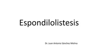 Espondilolistesis
Dr. Juan Antonio Sánchez Molina
 